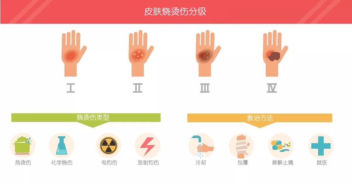 Degree-Of-Skin-Burns-Diagram.jpg